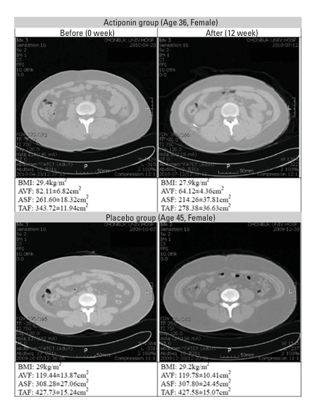 Figure 2: Study of the effects of ActivAMP