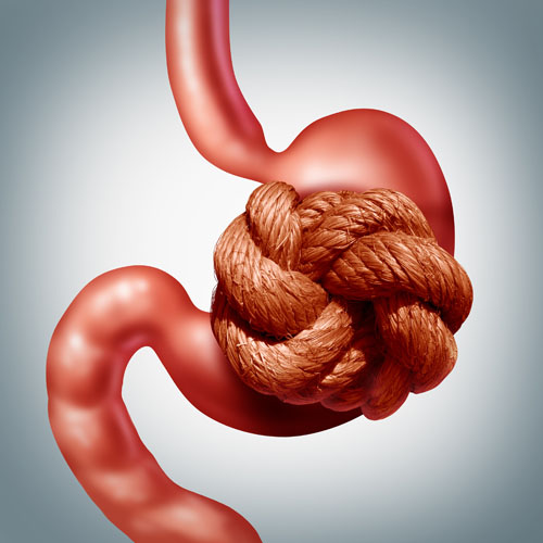 Clinical study demonstrates Probi’s new dual-strain probiotic improves constipation in healthy adults
