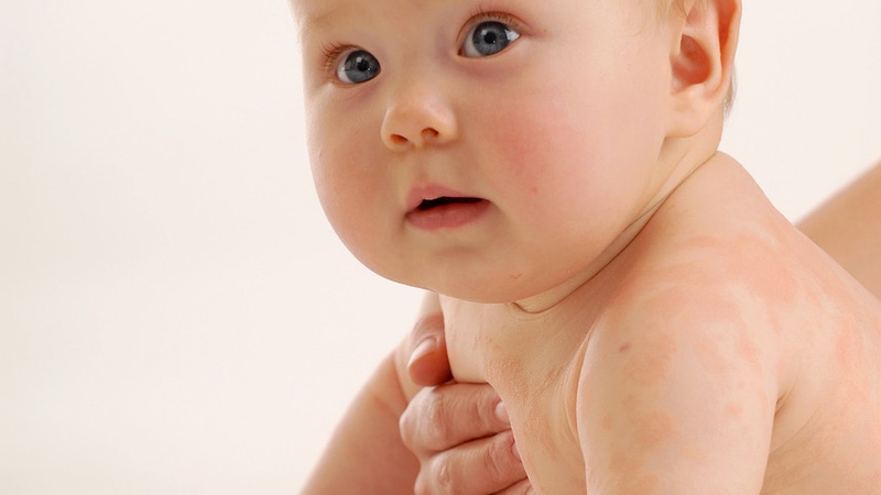 DuPont announces m infant health collaboration with APC Microbiome