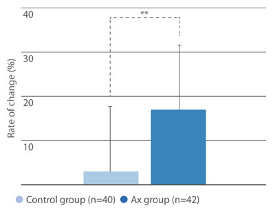 Figure 2: Another double blind study by showing a significant improvement in the accommodation ability in the Ax group after 4 weeks