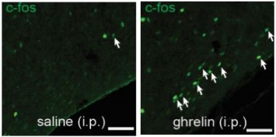 There are more activated SST neurons in the tuberal nucleus of mice injected with ghrelin compared with the control group