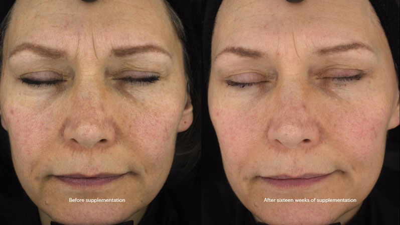 Seeing is believing: new study provides visible evidence  of benefits of Lycoderm for skin