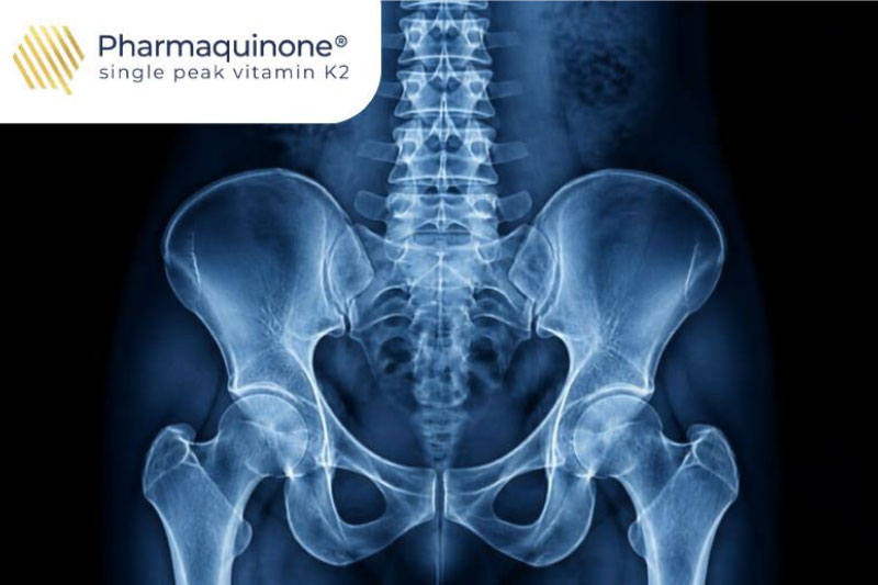 Beyond bone health: What emerging K2 clinical territories mean for supplement brands