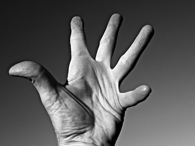 Bioiberica obtains authorisation to sell Mobilee in Australia and New Zealand