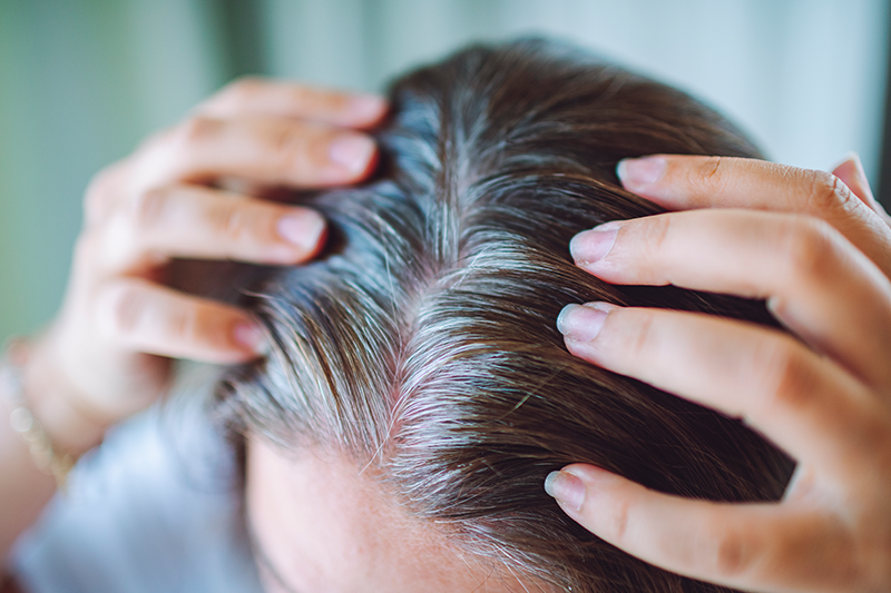 HairAge Vitae improves hair pigmentation and reduces grey hair density