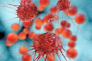 Higher serum vitamin D lowers breast cancer risk