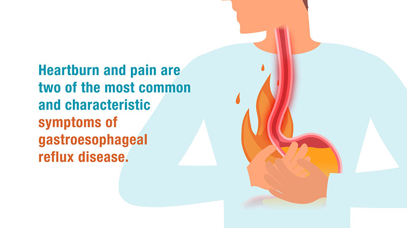 Keep GERD symptoms at bay with RefluG Isorepair