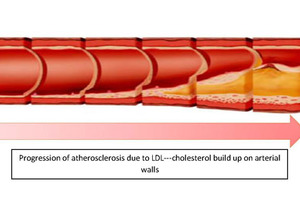 New research presented at Probiota 2017 demonstrates cholesterol-reducing microbiome modulation