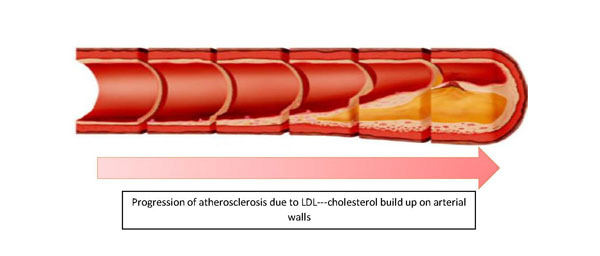 New research presented at Probiota 2017 demonstrates cholesterol-reducing microbiome modulation