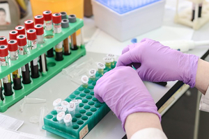 Nutraceutical ingredients that frequently fail quality testing