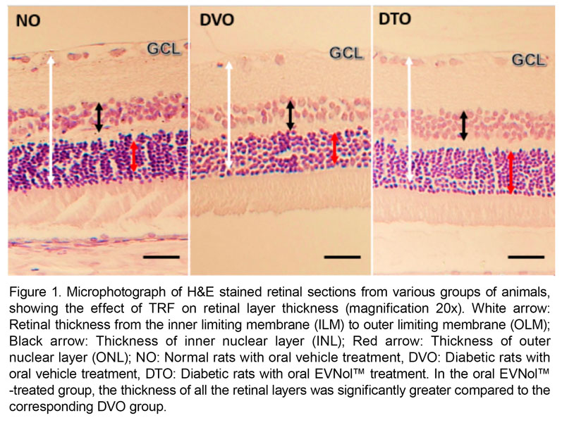 Palm tocotrienol complex protects against diabetic retinopathy