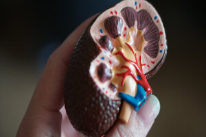 Potential vitamin K2 combination for CKD patients