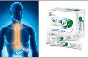 RefluG: strategies for the symptomatic relief of GORD