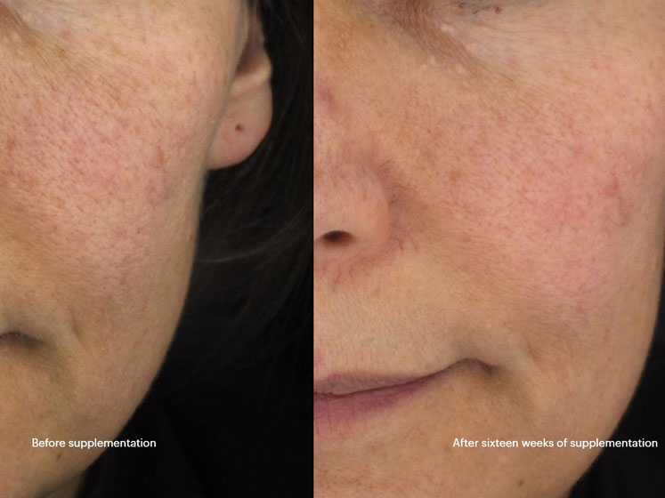 Seeing is believing: new study provides visible evidence  of benefits of Lycoderm for skin
