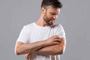 SkinBioTherapeutics receives approval to sell anti-Psoriasis food supplement