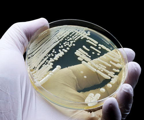 Synthetic sugar molecule points to new vaccine, antibody and diagnostic routes for drug-resistant hospital fungus